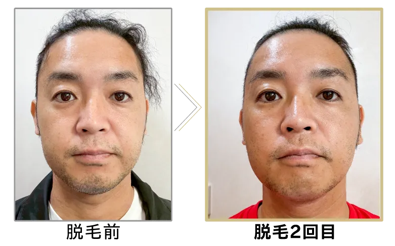 ビフォー・アフター画像